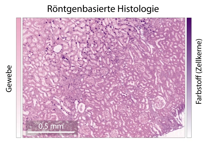 Image from Hereon press release on color X-ray imaging