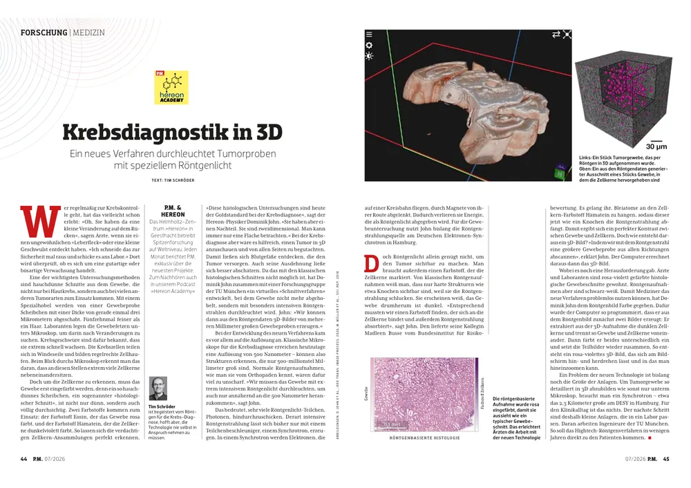 Article spread from P.M. magazine July 2026: Krebsdiagnostik in 3D