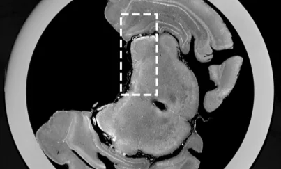 Phase-contrast X-ray CT reconstruction by Dr. Dominik John, Technical University of Munich